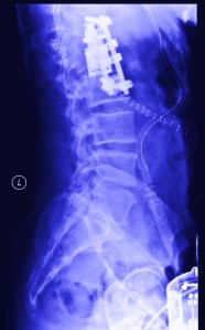 those little dots are staples..